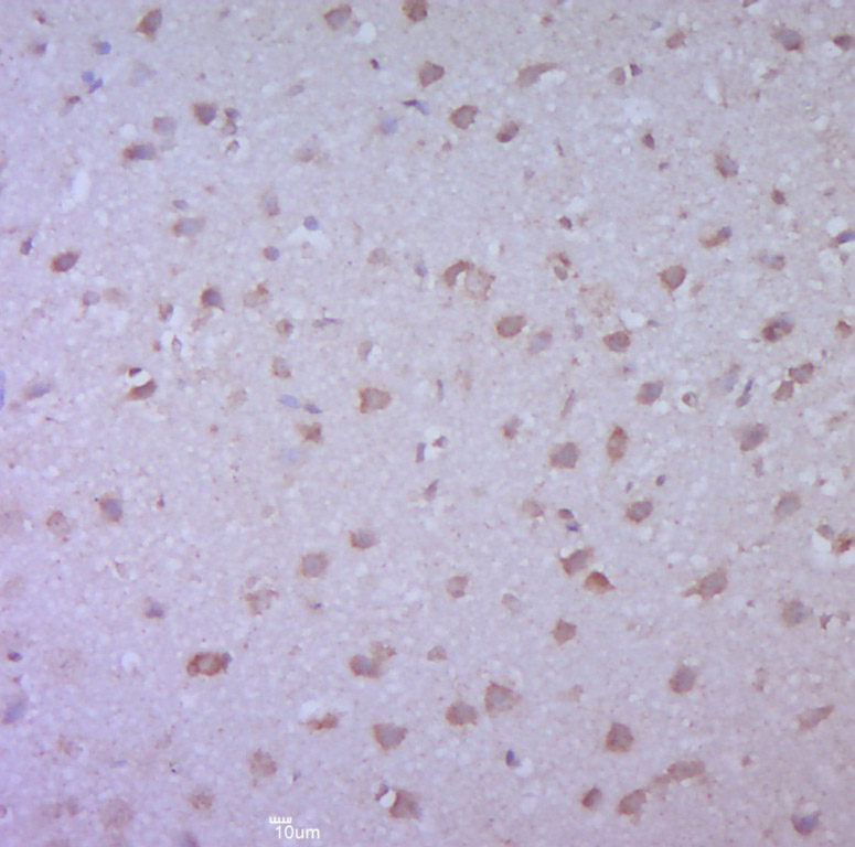 Cdc25B Rabbit pAb(bs-4094R)-50