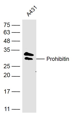 Prohibitin Rabbit pAb(bs-1449R