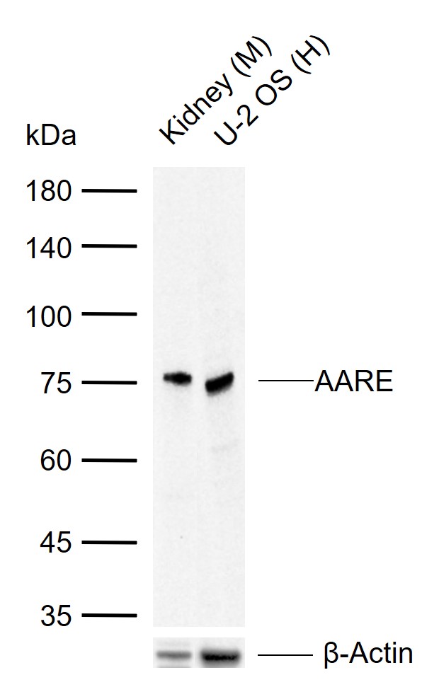 AARE Rabbit pAb(bs-5983R)-50ul