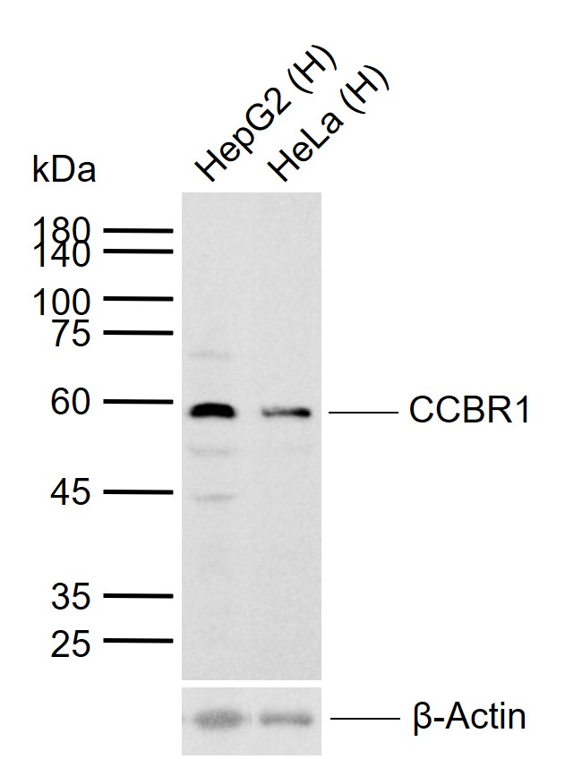 CCBR1 Rabbit pAb(bs-6883R)-50u