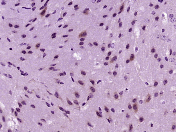 ACACA Rabbit pAb(bs-2745R)-50u