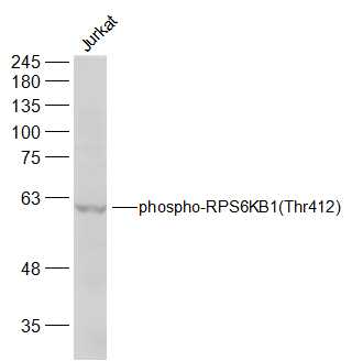 phospho-RPS6KB1 (Thr412) Rabbi
