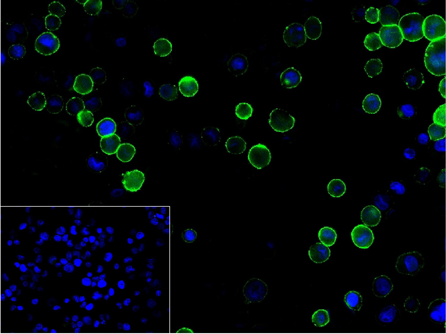 TNF alpha(1F6) Mouse mAb(bsm-0
