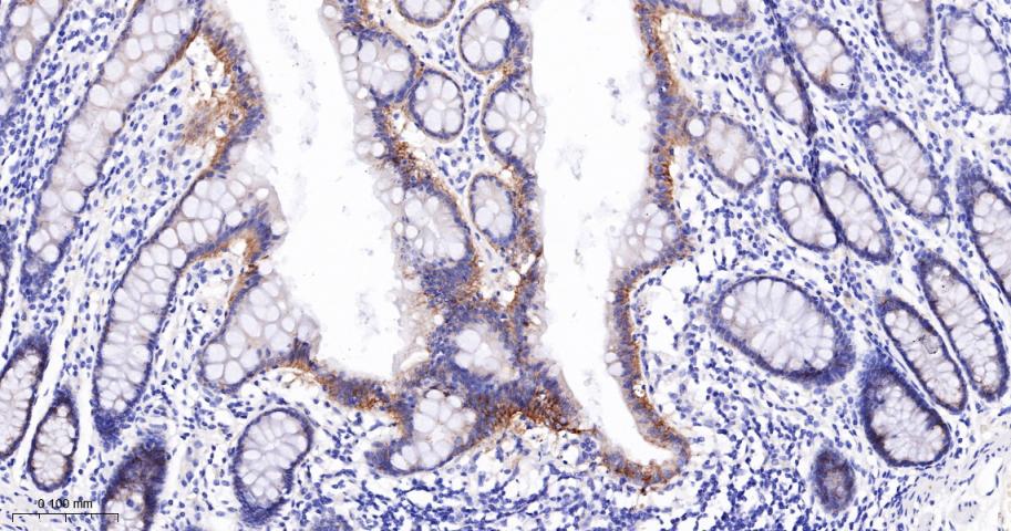 N-cadherin Mouse mAb(bsm-34125