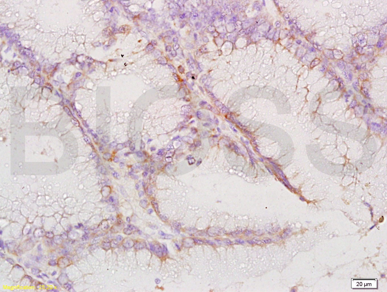 CCR-1/CD191 Rabbit pAb(bs-1169