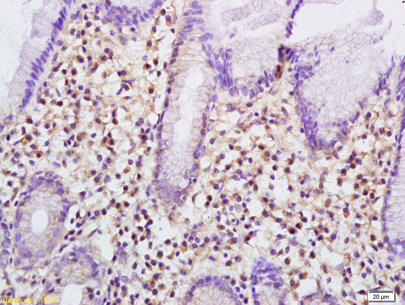 Plastin L Rabbit pAb(bs-7005R)