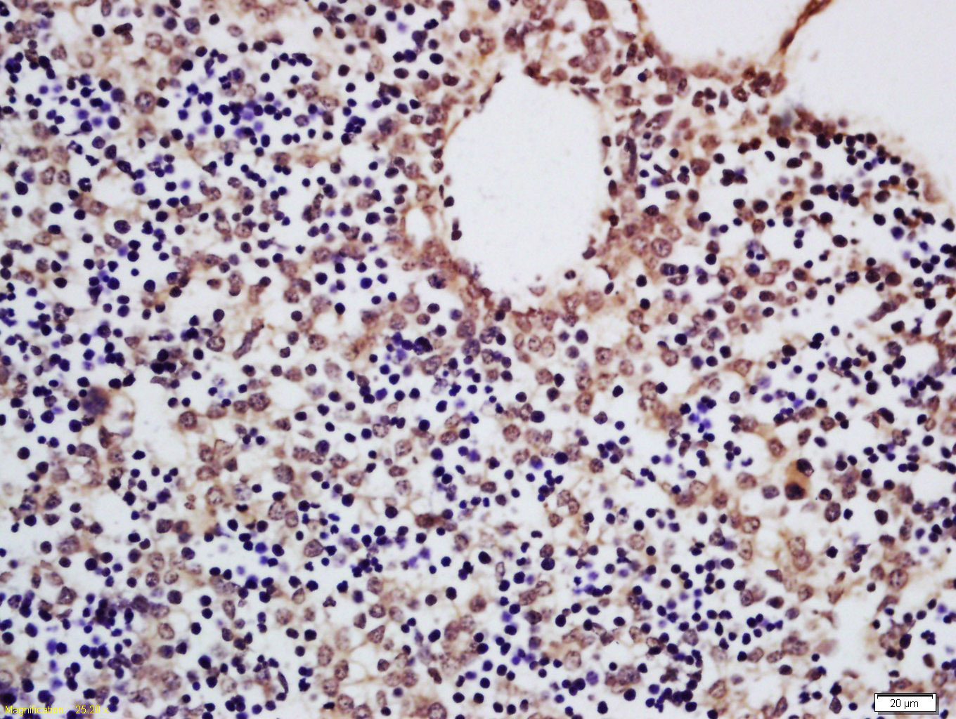 ENT2 Rabbit pAb(bs-10550R)-50u