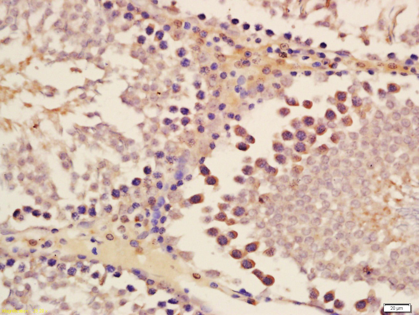 DNA Ligase III Rabbit pAb(bs-1