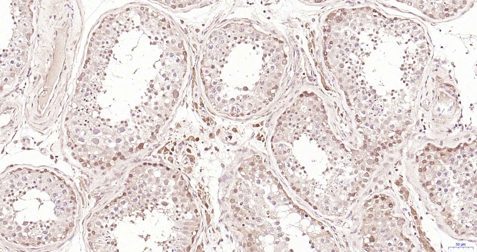 PSME3 Rabbit pAb(bs-4222R)-50u