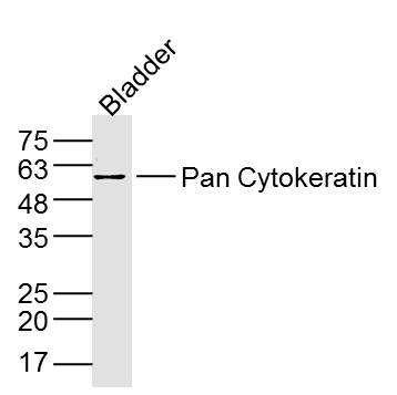 Pan Cytokeratin Rabbit pAb(bs-