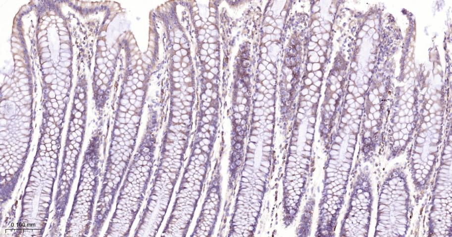 EIF2S1 Recombinant Rabbit mAb(