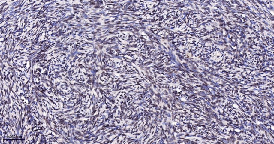 KDM4B Recombinant Rabbit mAb(b