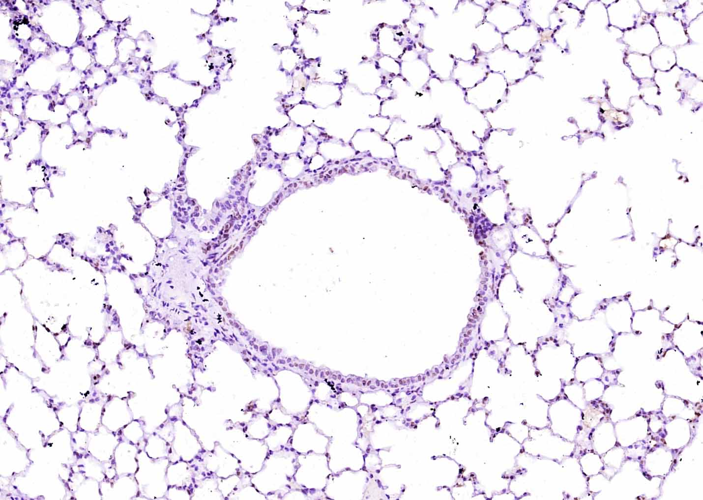 COL4A3/Tumstatin Rabbit pAb(bs