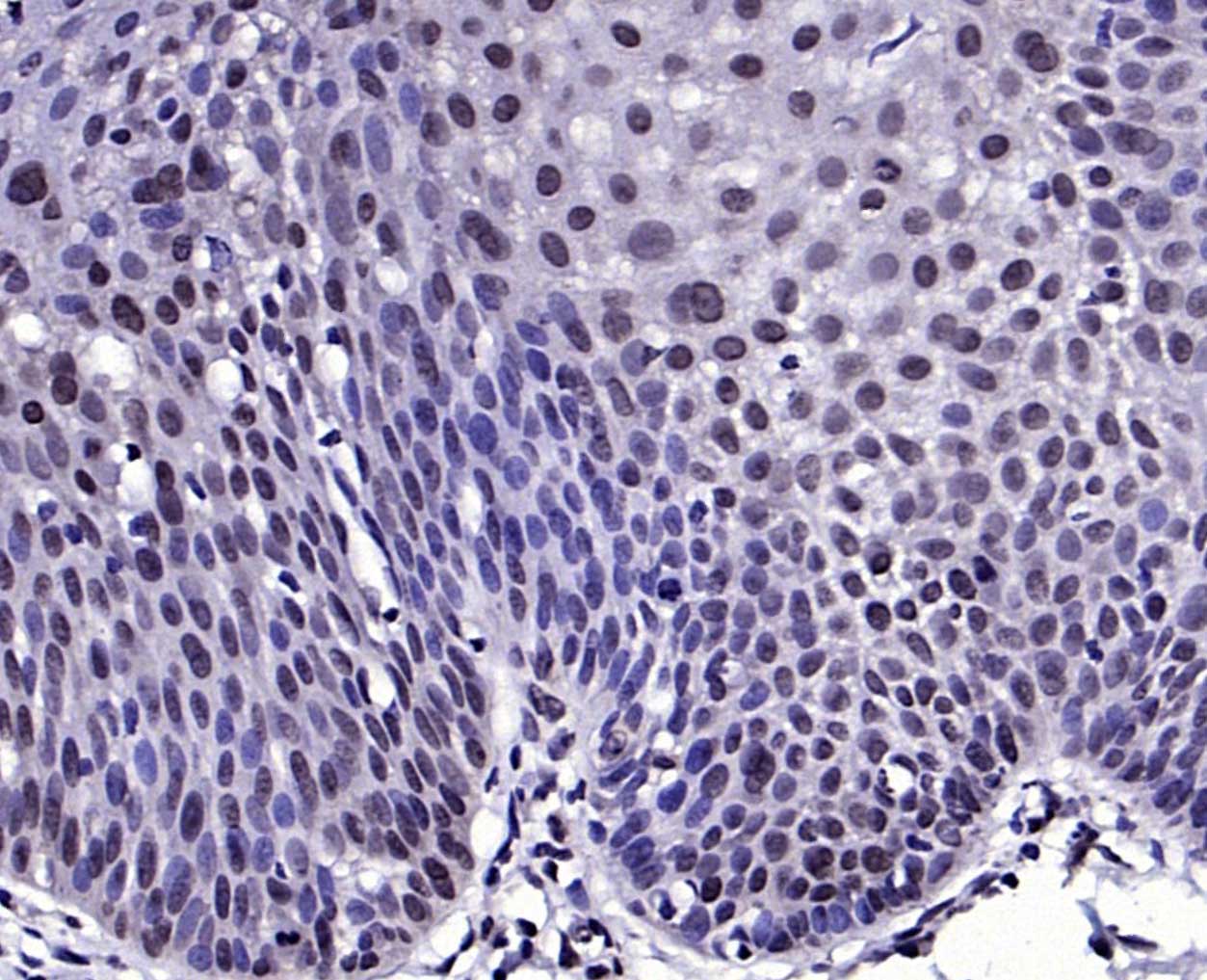 KAT4/TAF1 Rabbit pAb(bs-2812R)