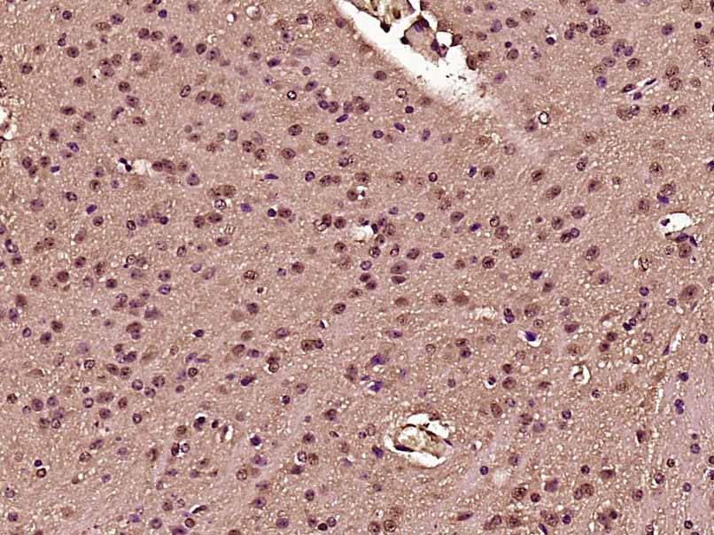 PTBP2 Rabbit pAb(bs-11928R)-50