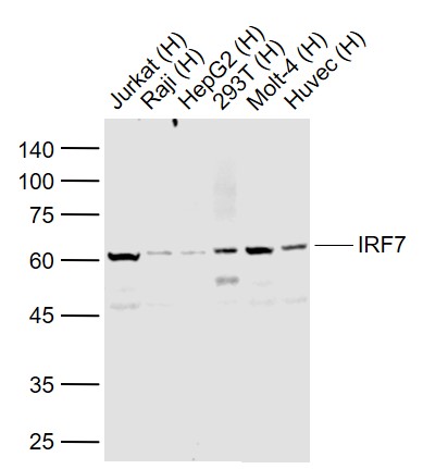 IRF7 Recombinant Rabbit mAb(bs