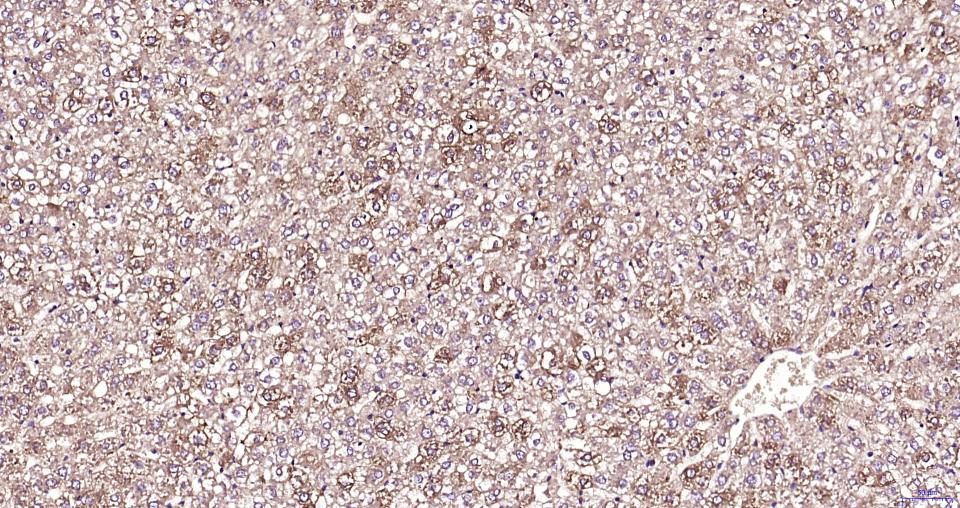 TBK1 Rabbit pAb(bs-7497R)-50ul