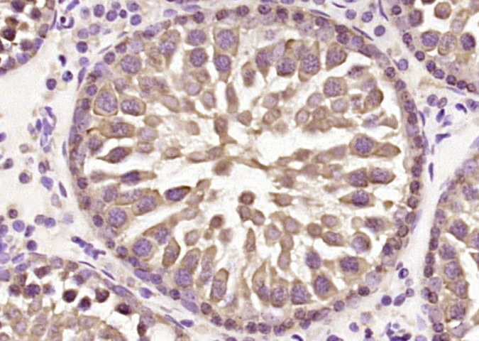 HCF2 Rabbit pAb(bs-9843R)-50ul