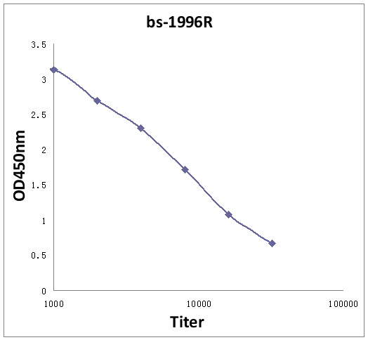CD171/L1CAM Rabbit pAb(bs-1996