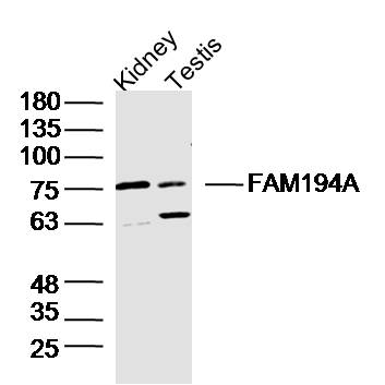 FAM194A Rabbit pAb(bs-14773R)-