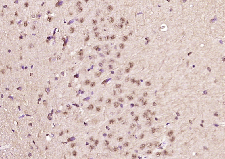 MDC1 Rabbit pAb(bs-2400R)-50ul