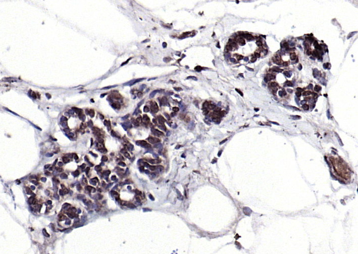 SPDEF Rabbit pAb(bs-1866R)-50u