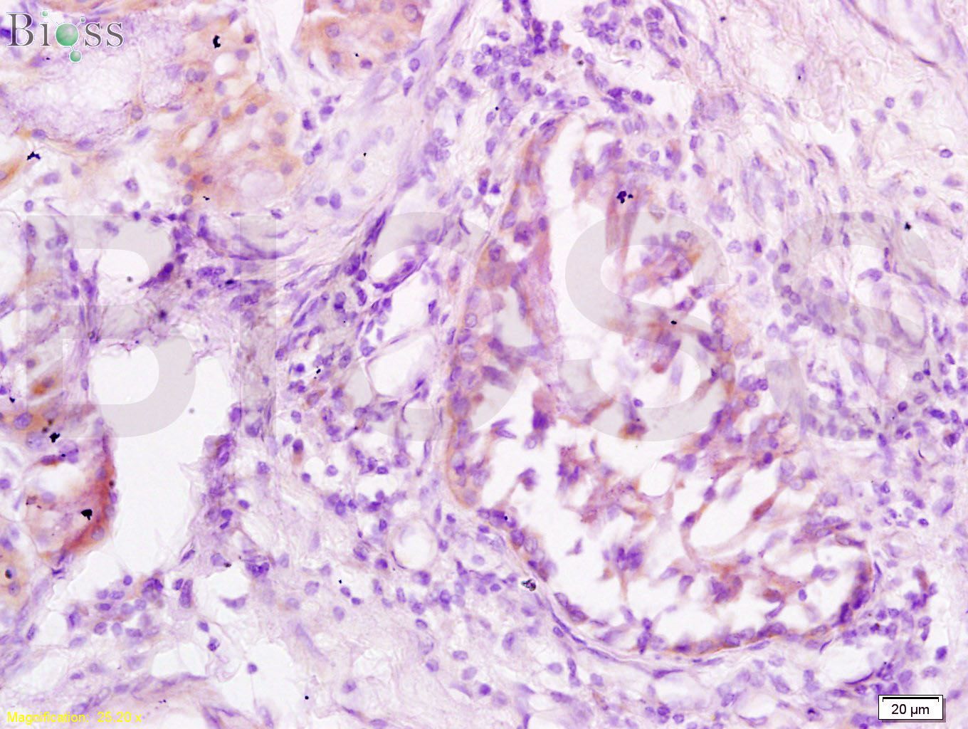 JNK1 + JNK3 Rabbit pAb(bs-0501