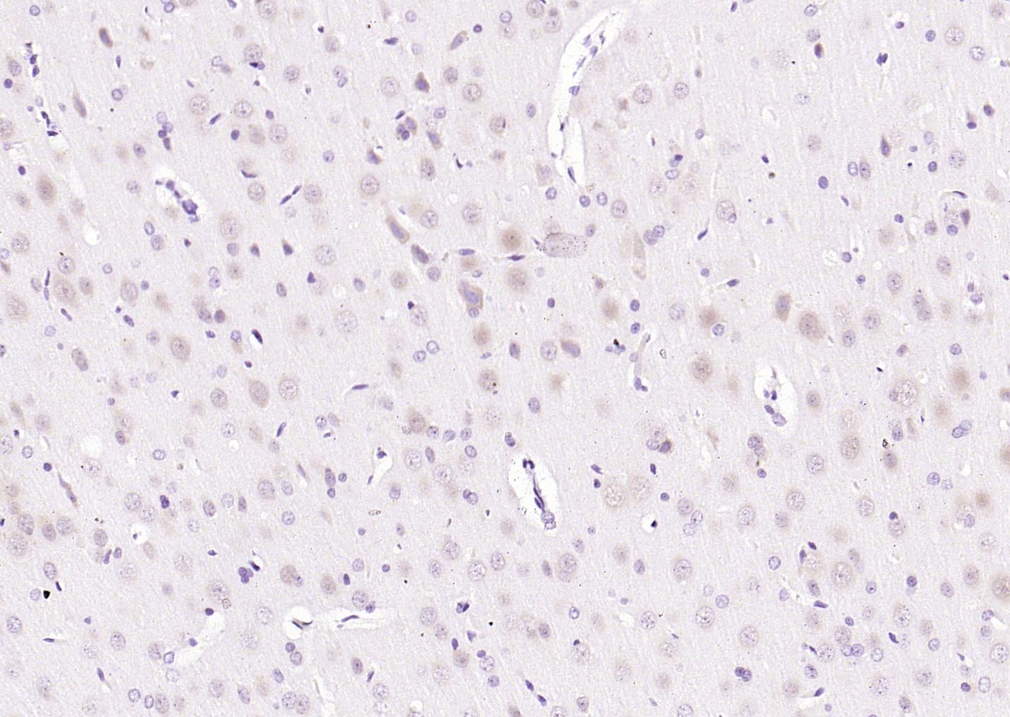 MAPK4 Rabbit pAb(bs-4131R)-50u