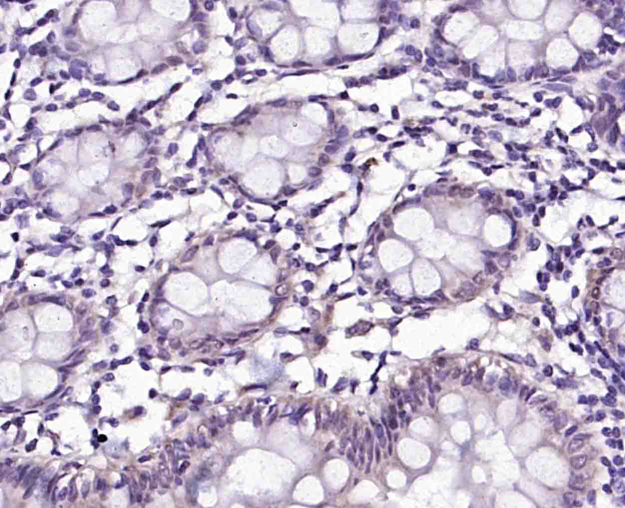 MAGEA4 Rabbit pAb(bs-3645R)-50