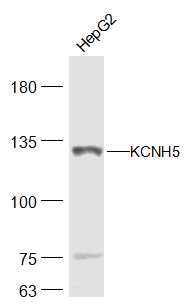 KCNH5 Rabbit pAb(bs-16886R)-50