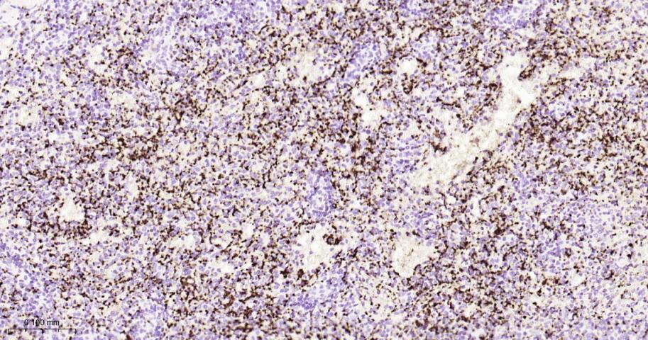 ITGB3 Recombinant Rabbit mAb(b