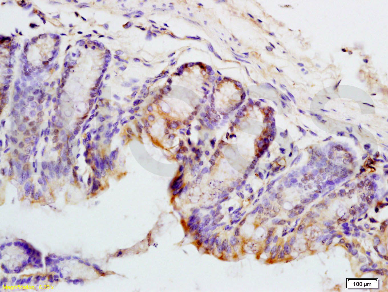 PAX9 Rabbit pAb(bs-1102R)-50ul