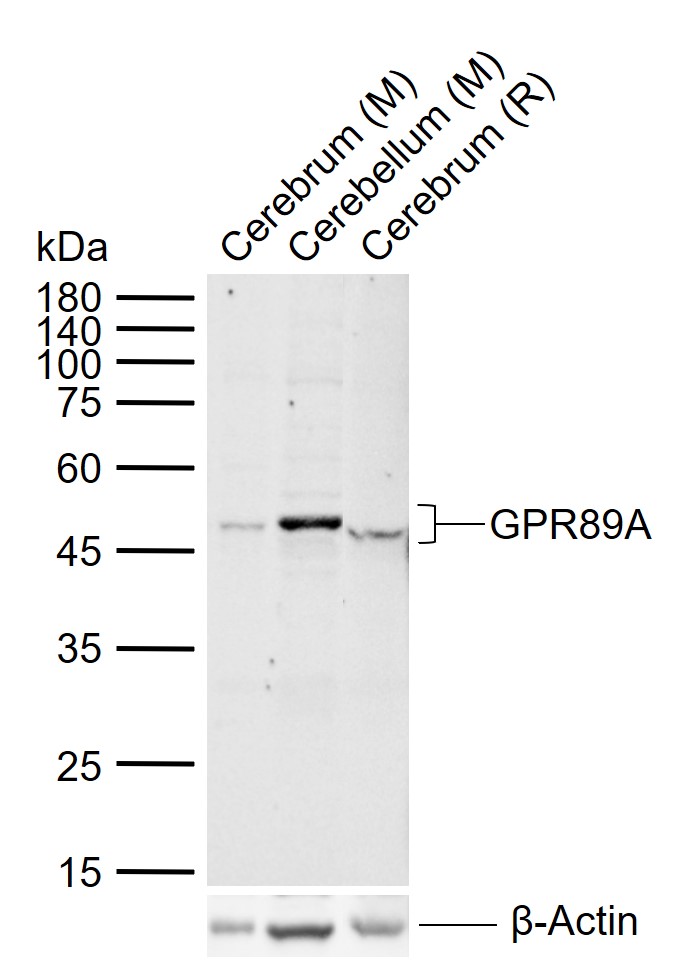 GPR89A Rabbit pAb(bs-15391R)-5