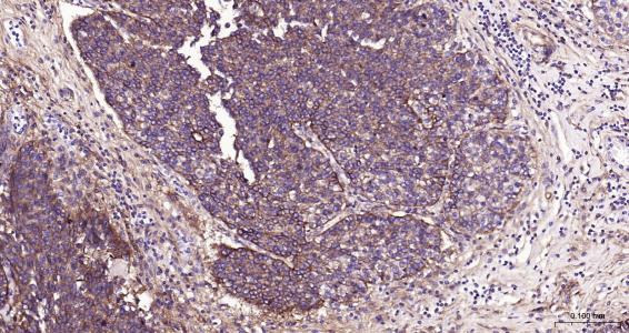 Integrin Alpha V Rabbit pAb(bs