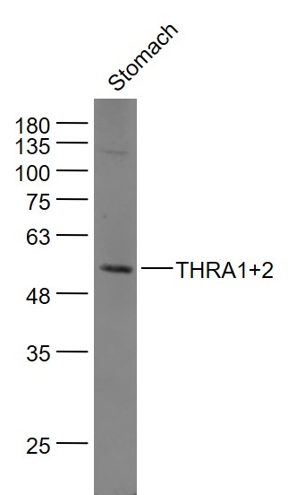 THRA1+2 Rabbit pAb(bs-6222R)-5