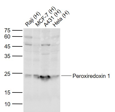 Peroxiredoxin 1 Rabbit pAb(bs-