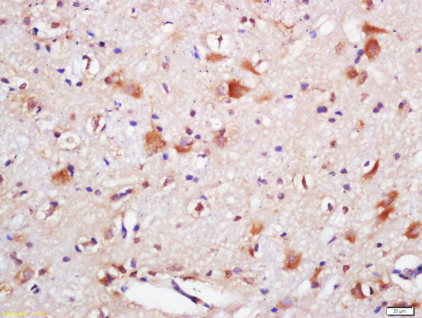 SQSTM1/P62 Rabbit pAb(bs-2951R