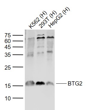 BTG2 Rabbit pAb(bs-0031R)-50ul
