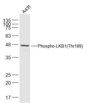 phospho-LKB1 (Thr189) Rabbit p