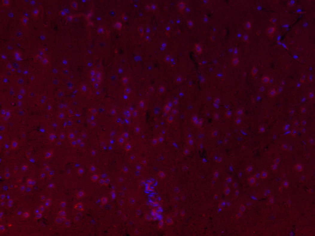 FSCN1 Rabbit pAb(bs-0796R)-50u