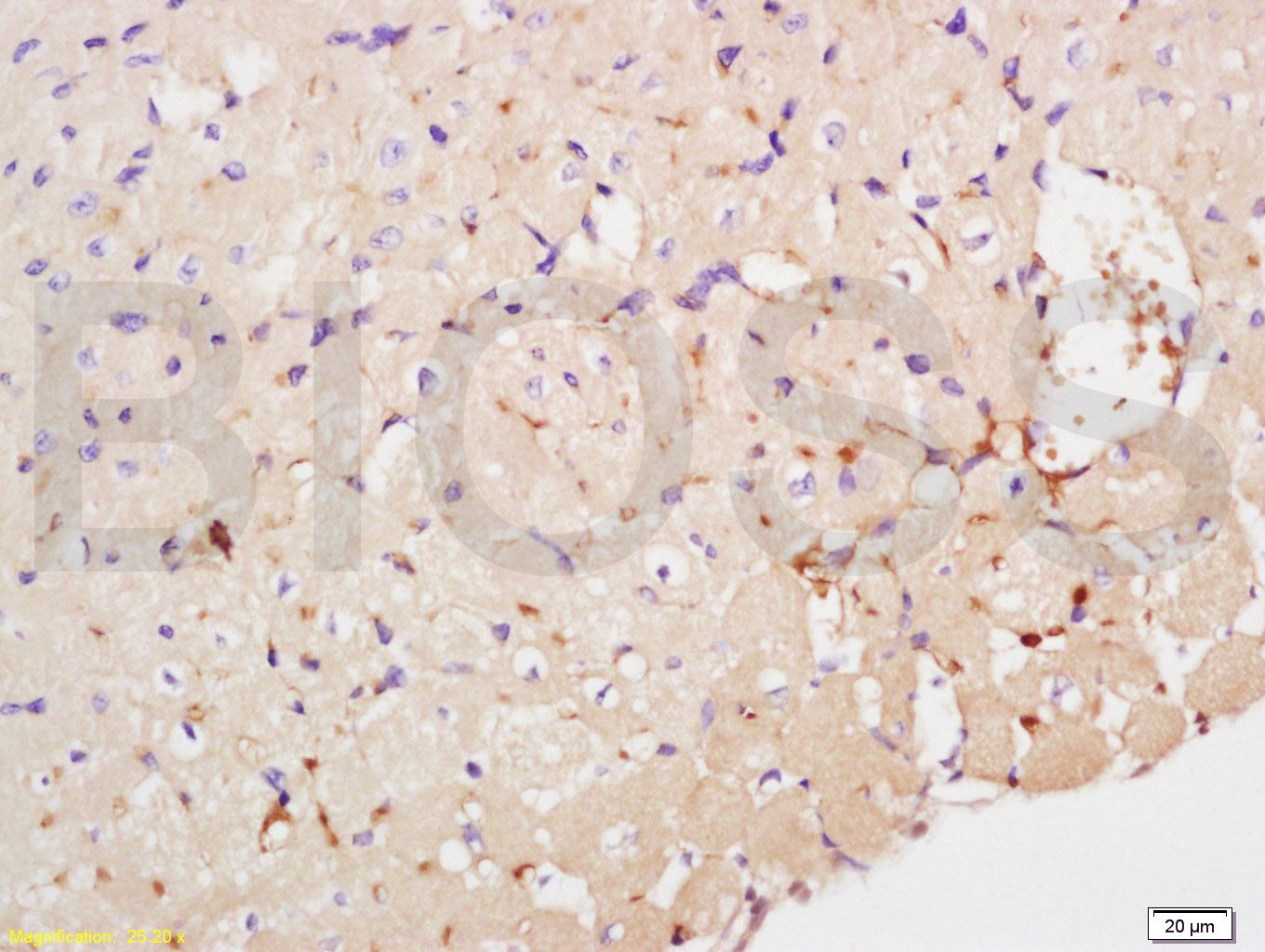 NME1/NM23A Rabbit pAb(bs-1066R