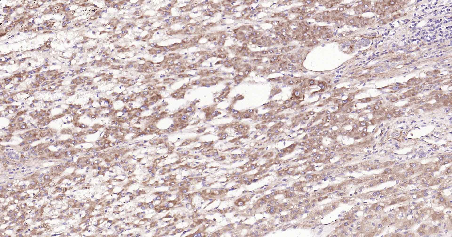 CYP7A1 Rabbit pAb(bs-2399R)-50