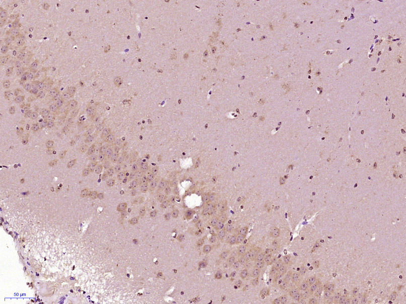 Site 2 protease Rabbit pAb(bs-