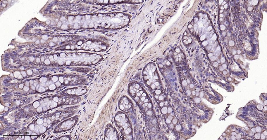 SIRT3 Rabbit pAb(bs-6105R)-50u