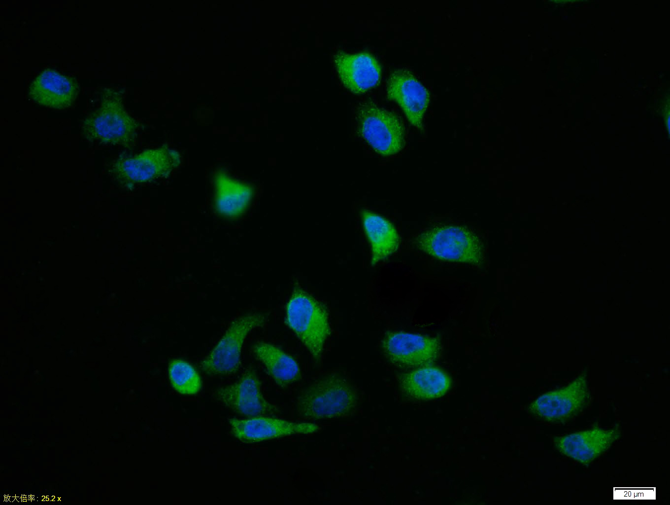 phospho-TERT (Ser1125) Rabbit 