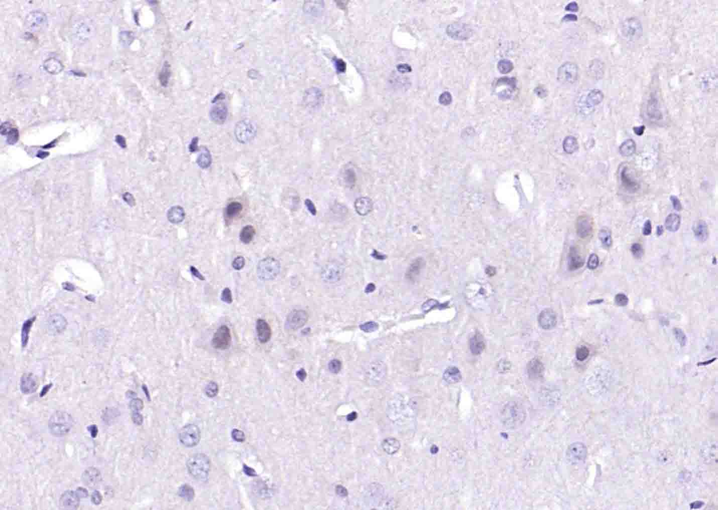 BRCA2 Rabbit pAb(bs-1210R)-50u