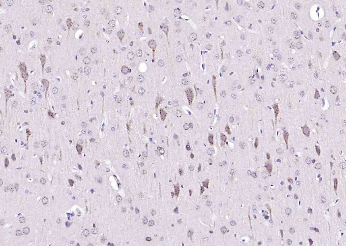 TPA Rabbit pAb(bs-1545R)-50ul/