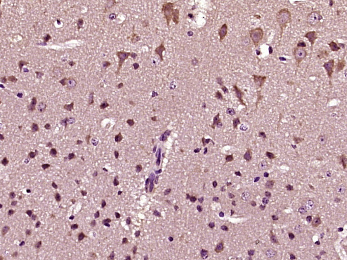 HCFC1R1 Rabbit pAb(bs-17359R)-