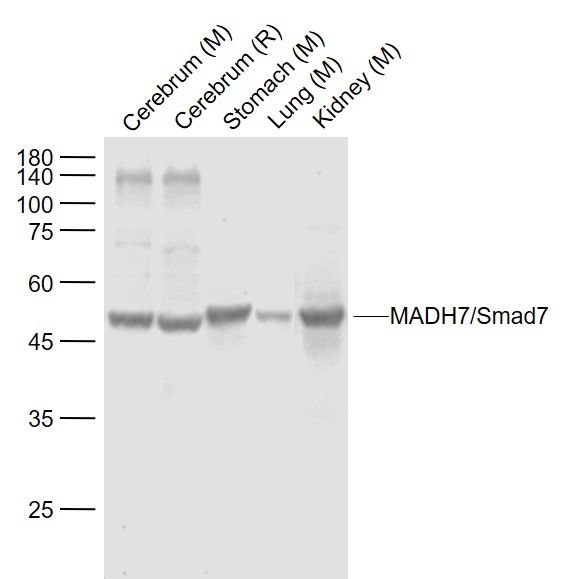 SMAD7 Rabbit pAb(bs-0566R)-50u