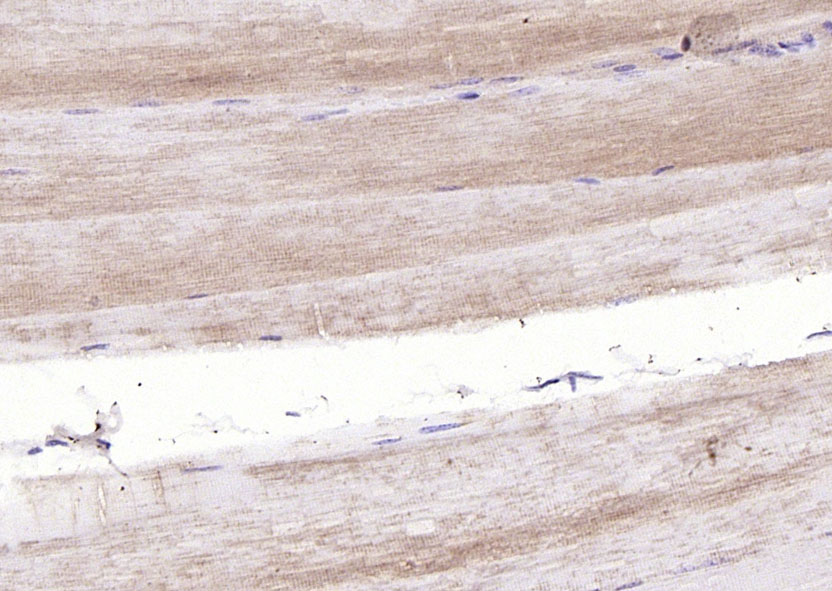 TNMD Rabbit pAb(bs-7525R)-50ul